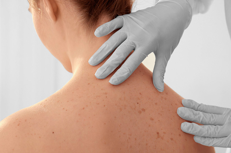 Tratamientos estéticos