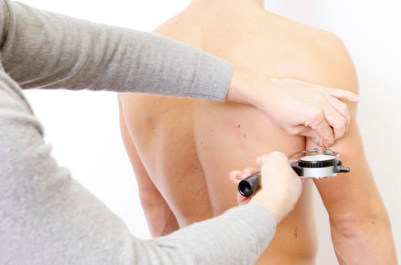 Tratamientos estéticos